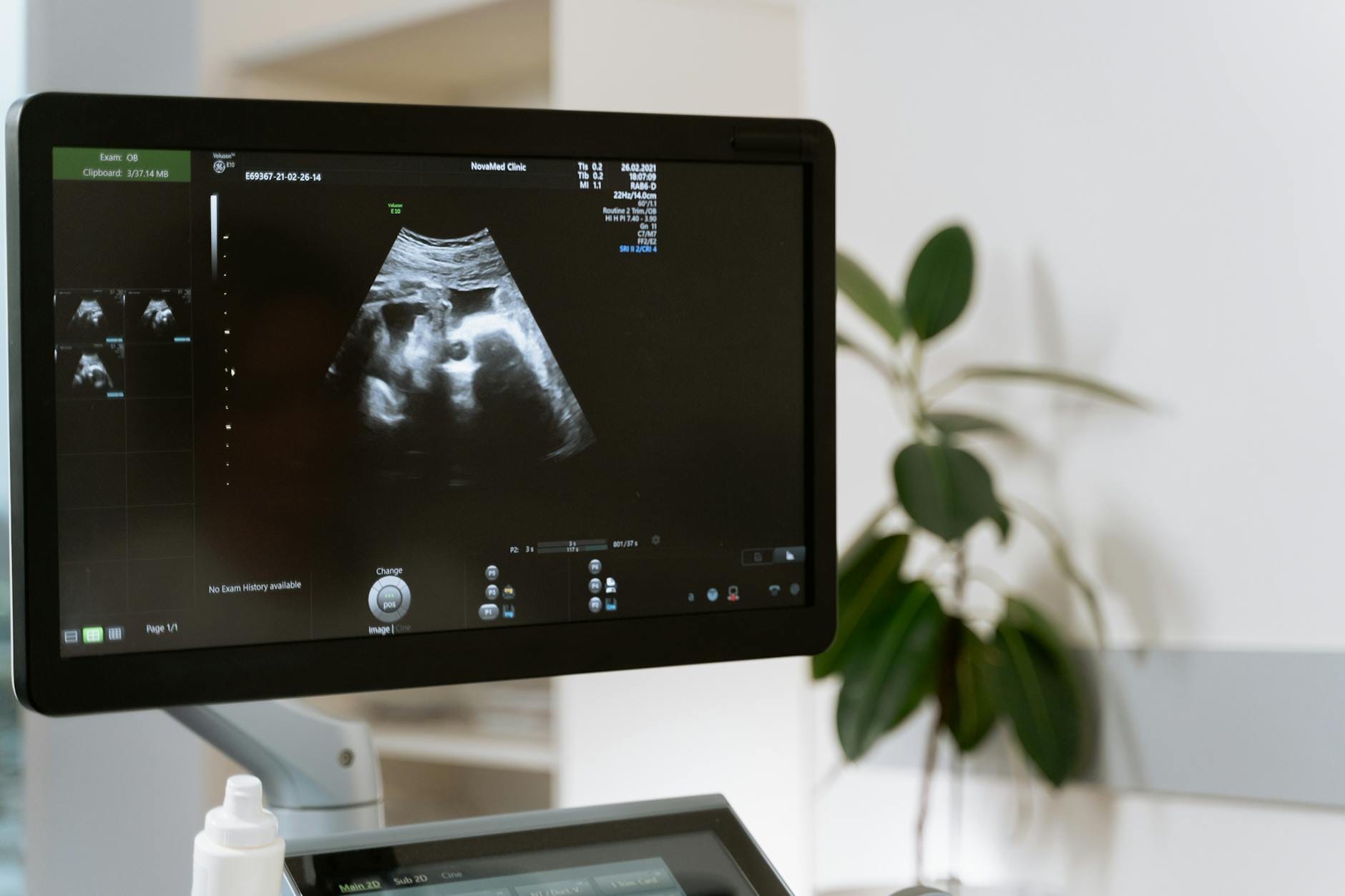 Badanie USG płodu widoczne na ekranie monitora w gabinecie lekarskim